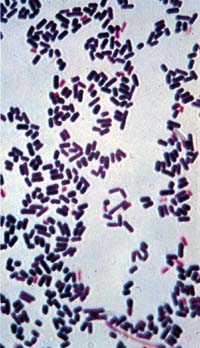 Grain-stain of equine intestinal tissue showing gram-positive rods of Clostridium perfingens (stained dark).